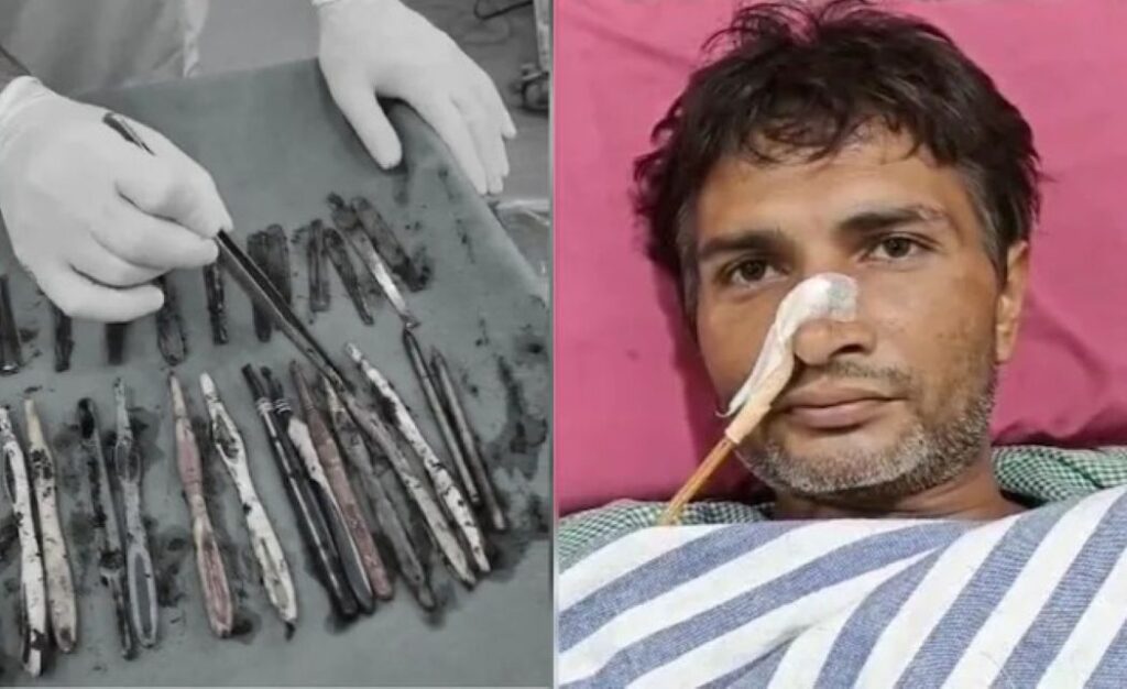 ରୋଗୀର ପେଟରୁ ବାହାରିଲା