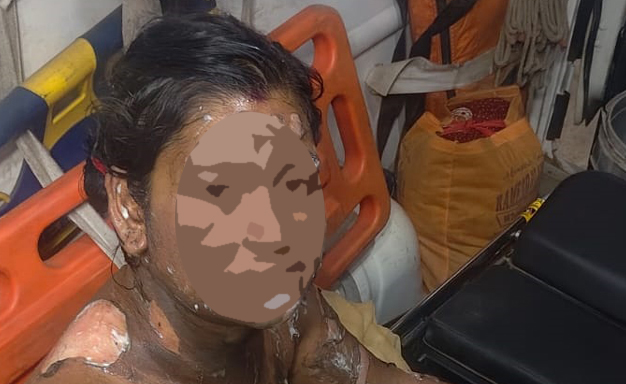 ଯୌତୁକ ଦାବିରେ ବୋହୂ ଉପରେ ପେଟ୍ରୋଲ ଢାଳି ହତ୍ୟା ଉଦ୍ୟମ