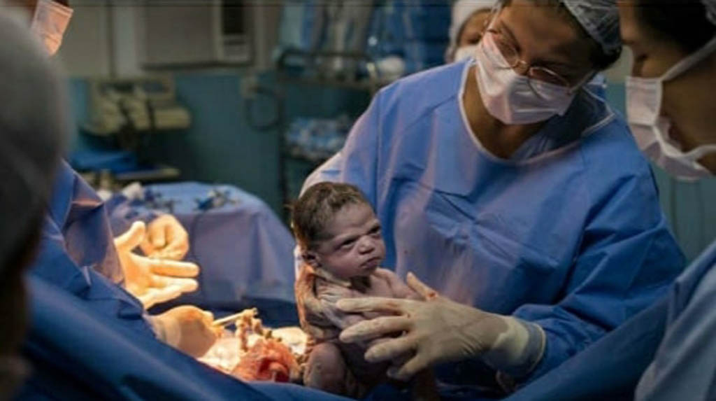 Newborn looks at doctor furiously, Netizens amused