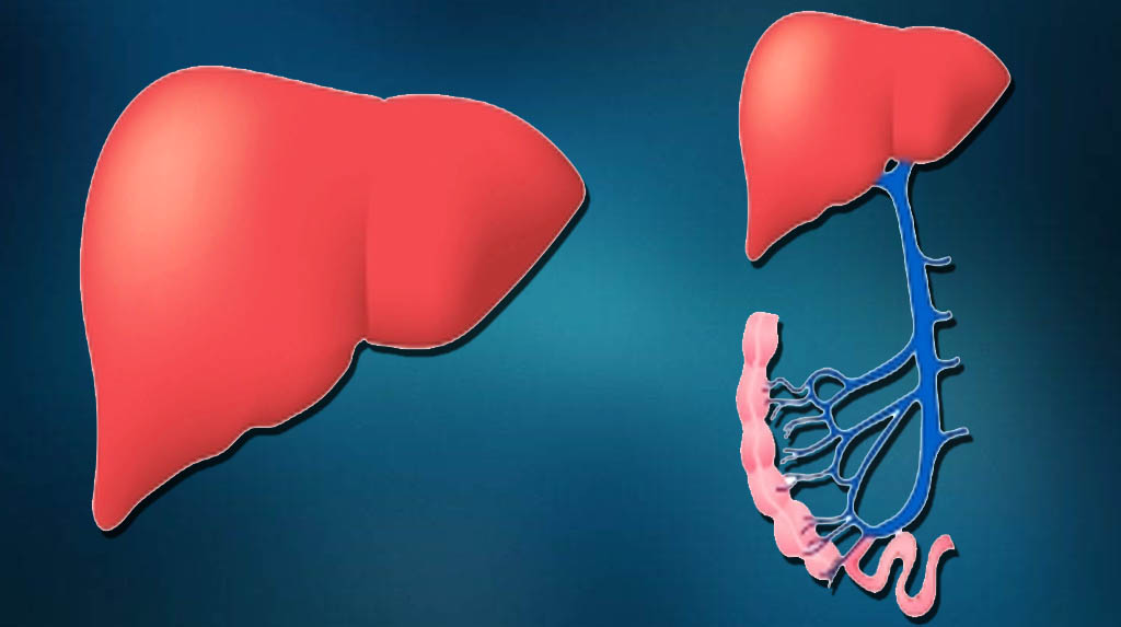 Researchers Develop Sensor To Detect Fatty Liver Disease The Samikhsya